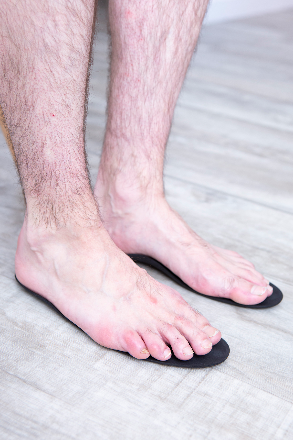 Relive Physiotherapy Blog Post